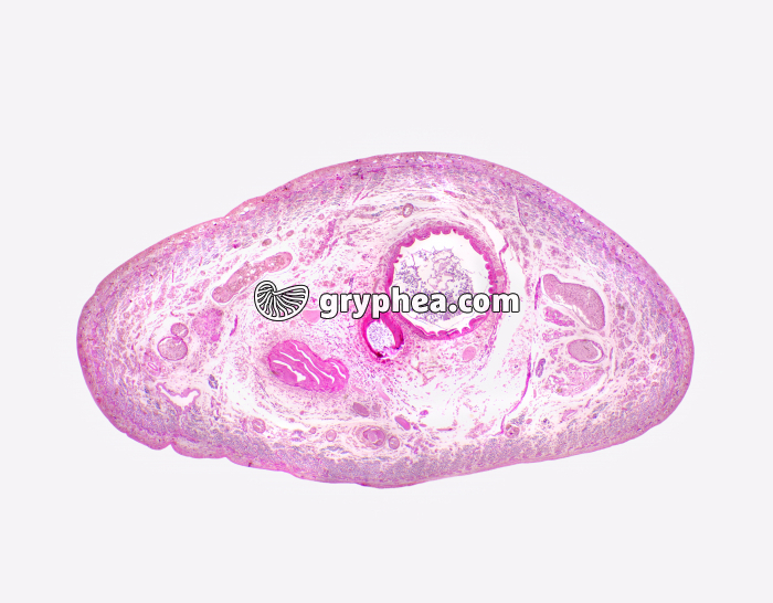 Sangsue - ver parasite (Hirundo sp.) en CT x7 - gryphea.org